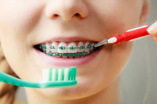 The Importance of Dental Hygiene with Braces