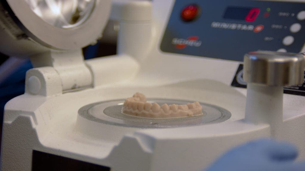 Aligners being made in the Roeder Orthodontics lab