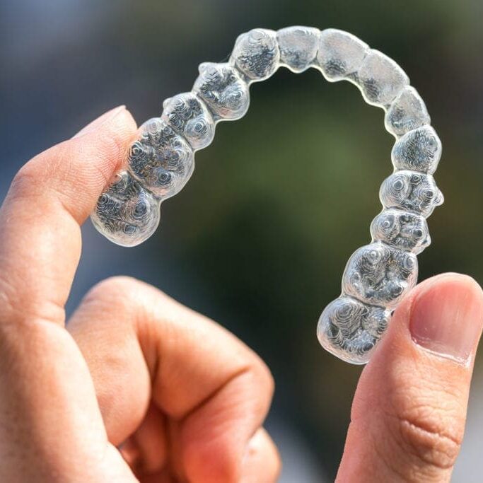 Close up shot of clear aligners